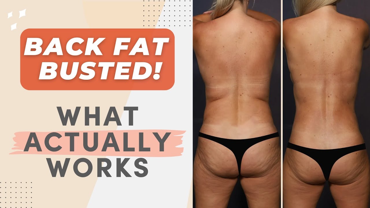 Back Fat Busted! Why Workouts Won’t Cut It & What Actually Works