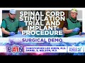 Spinal Cord Stimulation Trial & Implant Procedure Chris Ideen, M.D. & Dan Nelson, M.D.