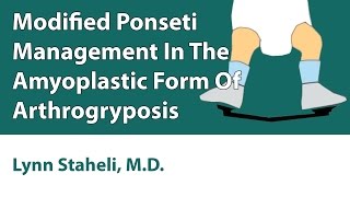 Modified Ponseti Management In The Amyoplastic For