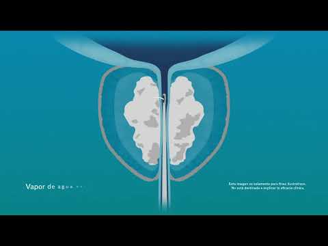 Axel Cayetano-15