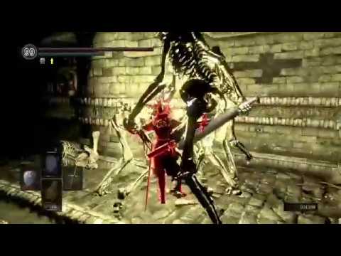 WELCOME TO THE BONE ZONE