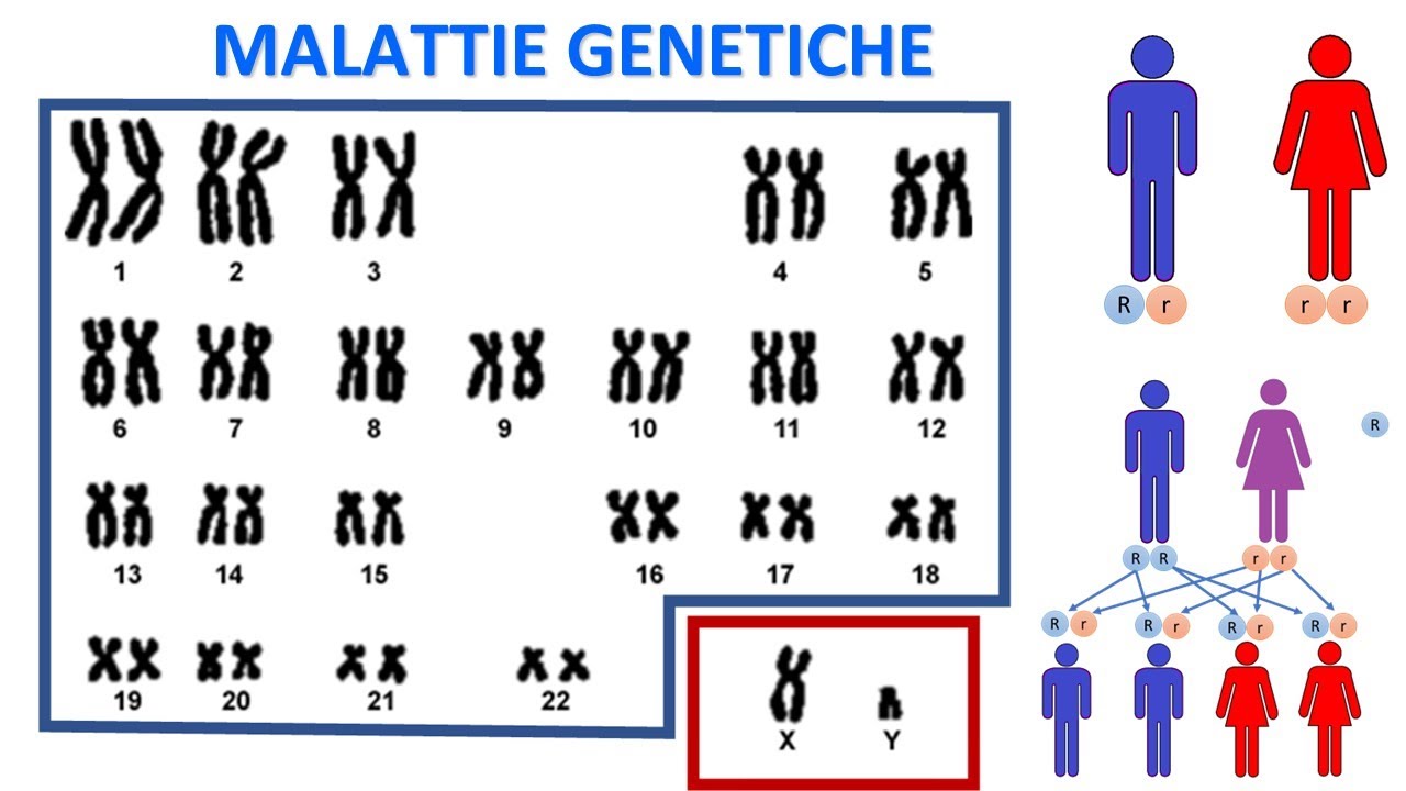 LE MALATTIE GENETICHE MENDELIANE