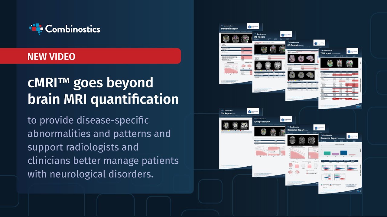 cMRI Reports Overview from Combinostics