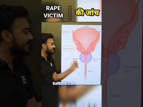 How do you investigate a rape victim? #shorts