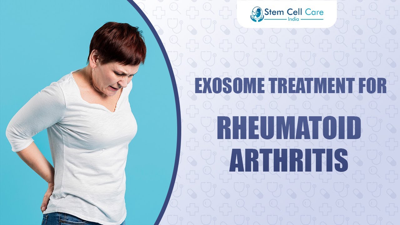 Exosome Therapy for Rheumatoid Arthritis | Natural Relief & Regeneration