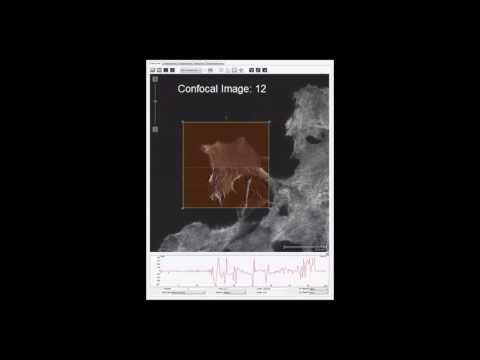 AFM | BioScope Resolve Seamless Optical Microscopy and AFM integration | Bruker