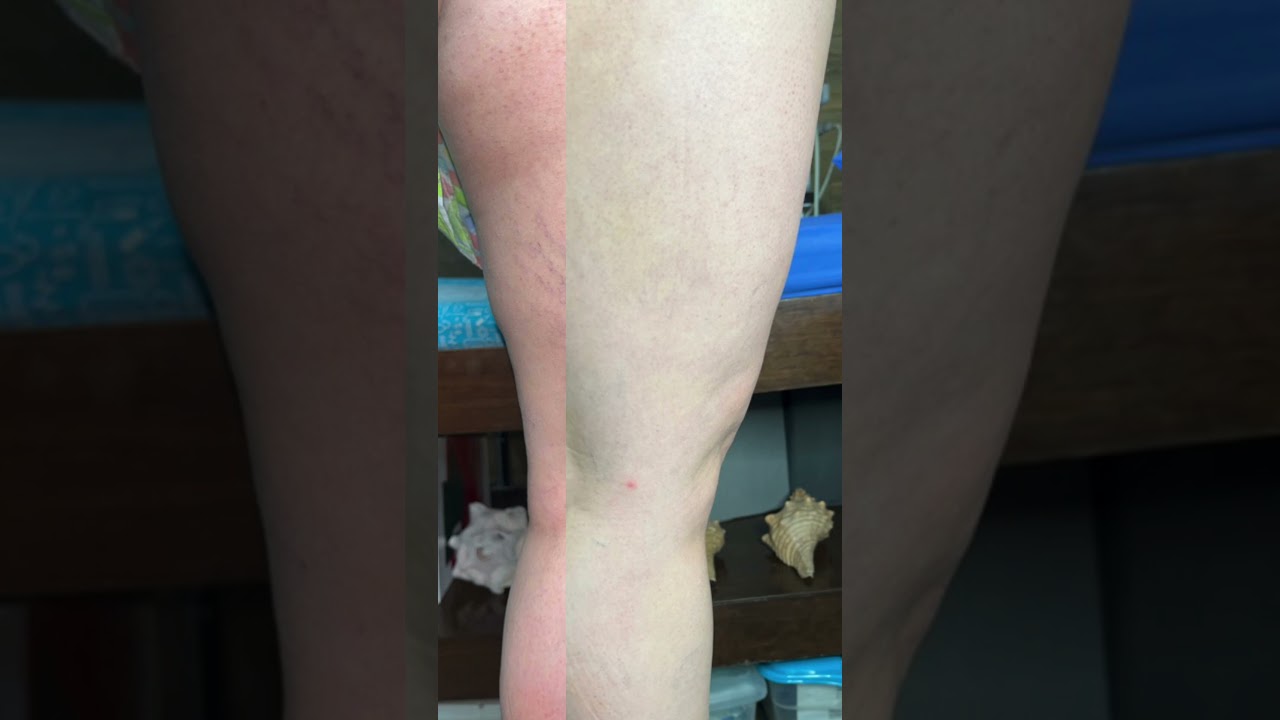 Carla Isabel Moreno Ramírez-30