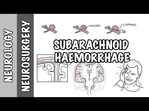 Subarachnoidalblutung / Pathophysiologie, Komplikationen und Management