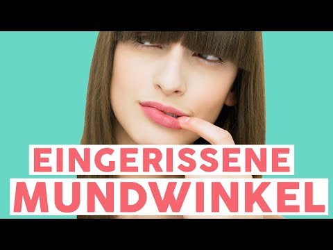 Was hilft bei eingerissenen Mundwinkeln? 💥