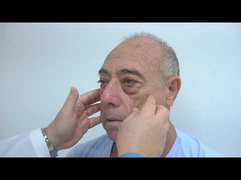 Avaliação clínica do paciente de hanseníase