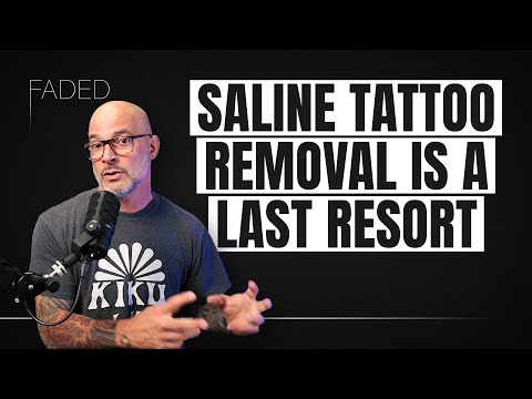 Saline Removal vs Laser Tattoo Removal