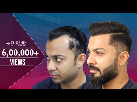 The best Hairline Ever recreated | Best Hair...
