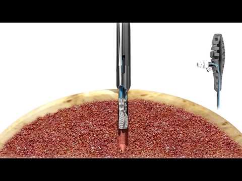 Manguito Rotador con Ancla Juggerknot 2.9mm