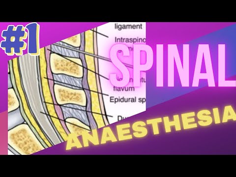 HOW TO PERFORM SPINAL ANAESTHESIA? - PART 1