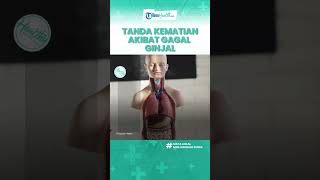 Bahaya Gagal Ginjal Dapat Mengancam Nyawa, Kenali Tanda Kematian yang Pantang Disepelekan
