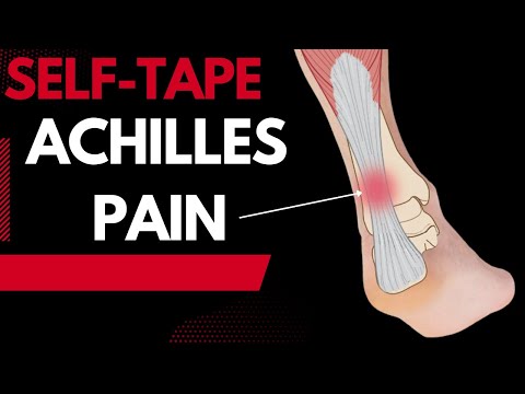 Do you have Achilles Tendon or Heel Pain? Then try this Kinesiology Taping technique...
