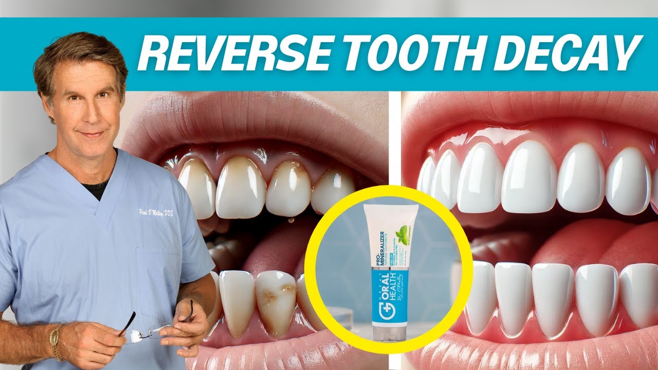 What is nano-hydroxyapatite? Can it reverse tooth decay?