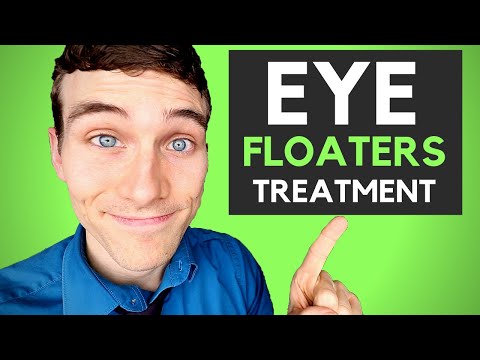🔴How to Get Rid of Eye Floaters - 3 Eye Floaters Treatments Video
