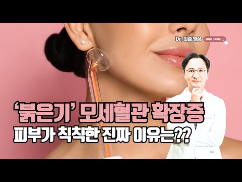 피부가 칙칙한 진짜 이유는 '붉은기' - 모세혈관확장증