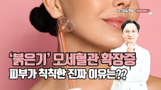 Why Dull Skin May Actually Be Redness: Telangiectasia
