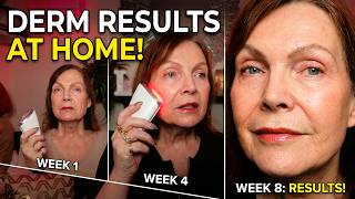 Skip the Dermatologist? Testing Lumeo SkinLift 4D Current™ on Mature Skin!