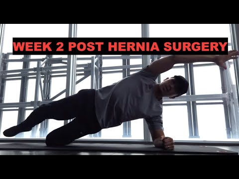 2 Weeks After Hernia Surgery Exercises