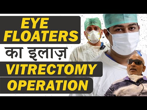 Eye Floaters Treatment by Vitrectomy Surgery - Near LIVE Surgery | Best Retinal Treatment at Eye7