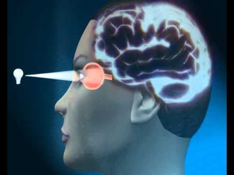 How Does Glaucoma Develop? 