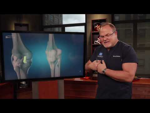 Dr. Mark Adickes: When do you do surgery on a PCL tear?