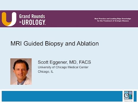 MRI Guided Biopsy and Ablation