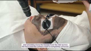 Download the video "How to Do Treatment with The 2-In-1 Picosecond 808 Diode Laser Hair Removal Machine | HR-AS64"