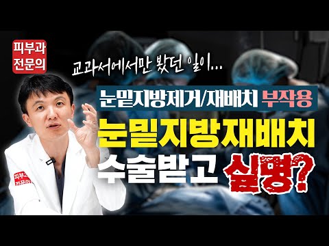 눈밑지방재배치 수술 받고 실명... 눈밑지방제거 부작용 어떤 것들이 있을까요?