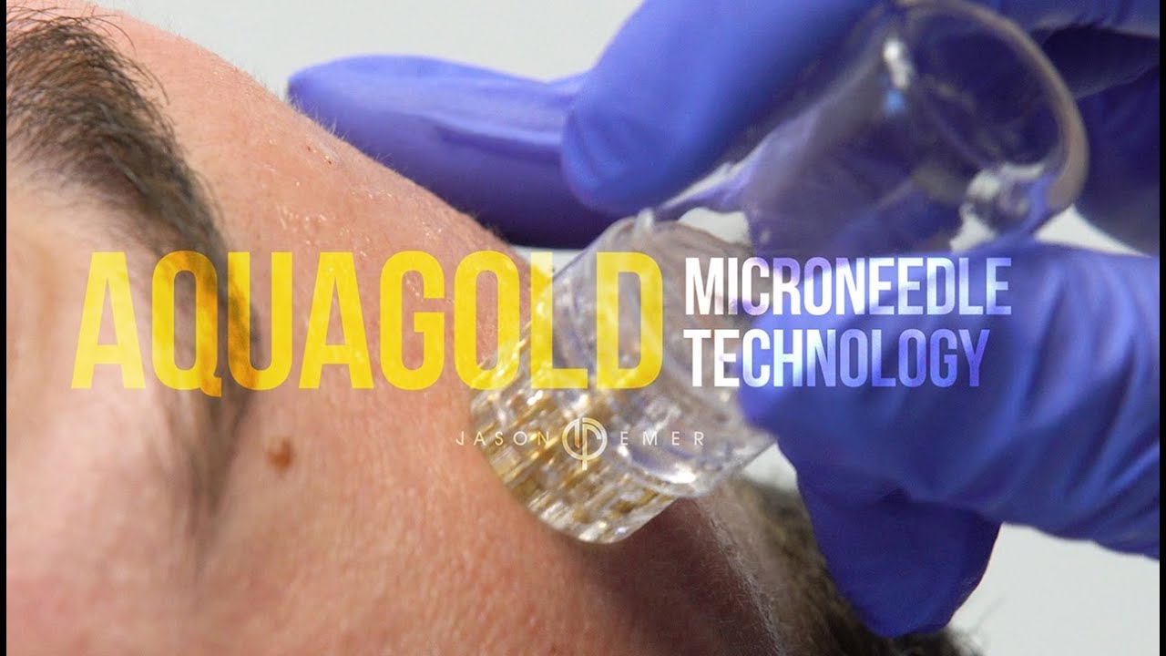 AQUAGOLD Fine Touch | Skin Rejuvenation | Dr. Jason Emer | Beverly Hills