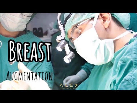 เสริมหน้าอกส่องกล้องด้วยเทคโนโลยีจากเยอรมัน (ทำหน้าอกเชียงใหม่) l Dr.Alex