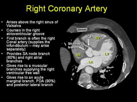 Coronary Arterial Anatomy