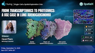 EP52: From Transcriptomics to Proteomics: A Use Case in Lung Adenocarcinoma