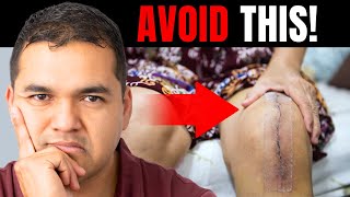 10 Daily Habits That Can Help You Avoid Knee Replacement