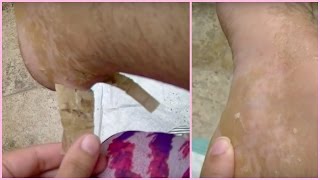 getting cast off... GROSS!!!