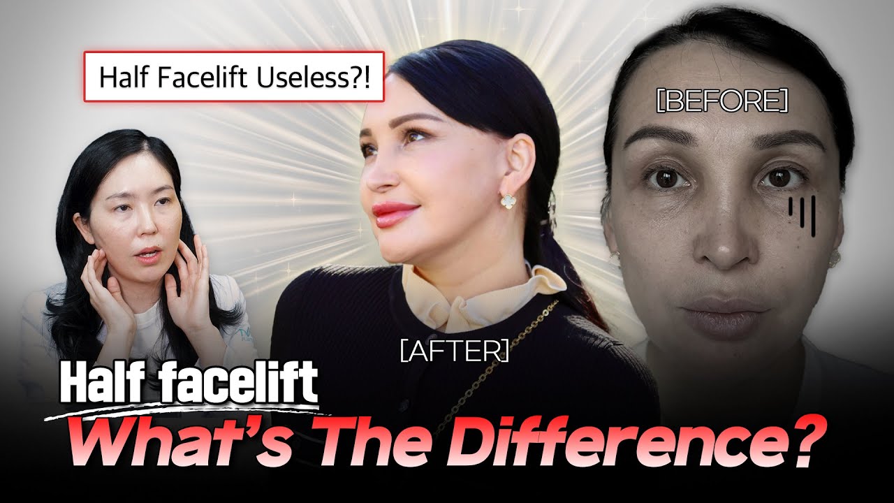 Is a half facelift really useless review of lifting surgery options NANA Korea YouTube video