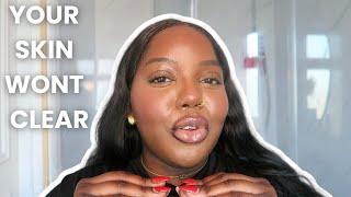 This is why your acne is NOT clearing.....