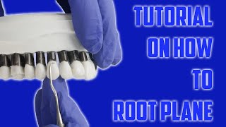 Dental Root Planing 101 - Step-by-Step