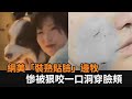 別人的狗別亂摸！網美「裝熟貼臉」邊牧　慘被狠咬一口洞穿臉頰－全民話燒