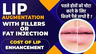 Watch video Lip Augmentation With Fillers Or Fat Injection | Cost Of Lip Enhancement In Delhi By Dr PK Talwar Now Lip Augmentation With Fillers Or Fat Injection | Cost Of Lip Enhancement In Delhi By Dr PK Talwar
