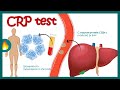 C Reactive Protein CRP Inflammation Acute Phase Reactant How Do You Read CRP Test Results