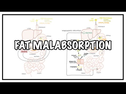 Approche de la malabsorption des graisses - signes, symptômes et causes