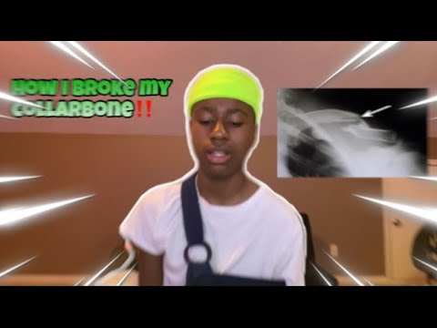 HOW I BROKE MY COLLARBONE🦴🤕💔(storytime)
