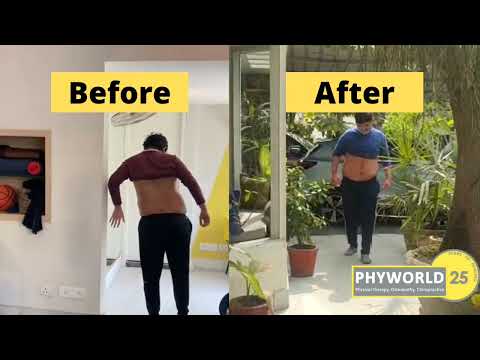 Sciatica treatment | Know it all from Dr Vandana Jaisingh | PHYWorld