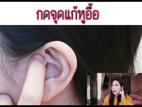 Palmar-ฝ่าเท้ารูปภาพโรคสะเก็ดเงิน กลากที่เท้าของเชื้อแบคทีเรีย