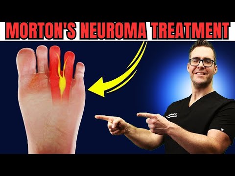 Heel Spurs Plantar Fasciitis BEST Home Treatment 2022