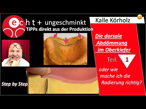 Die dorsale Abdämmung im Oberkiefer - TEIL 1